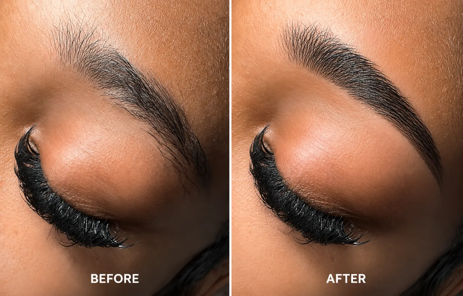 Brow treatment before and after result