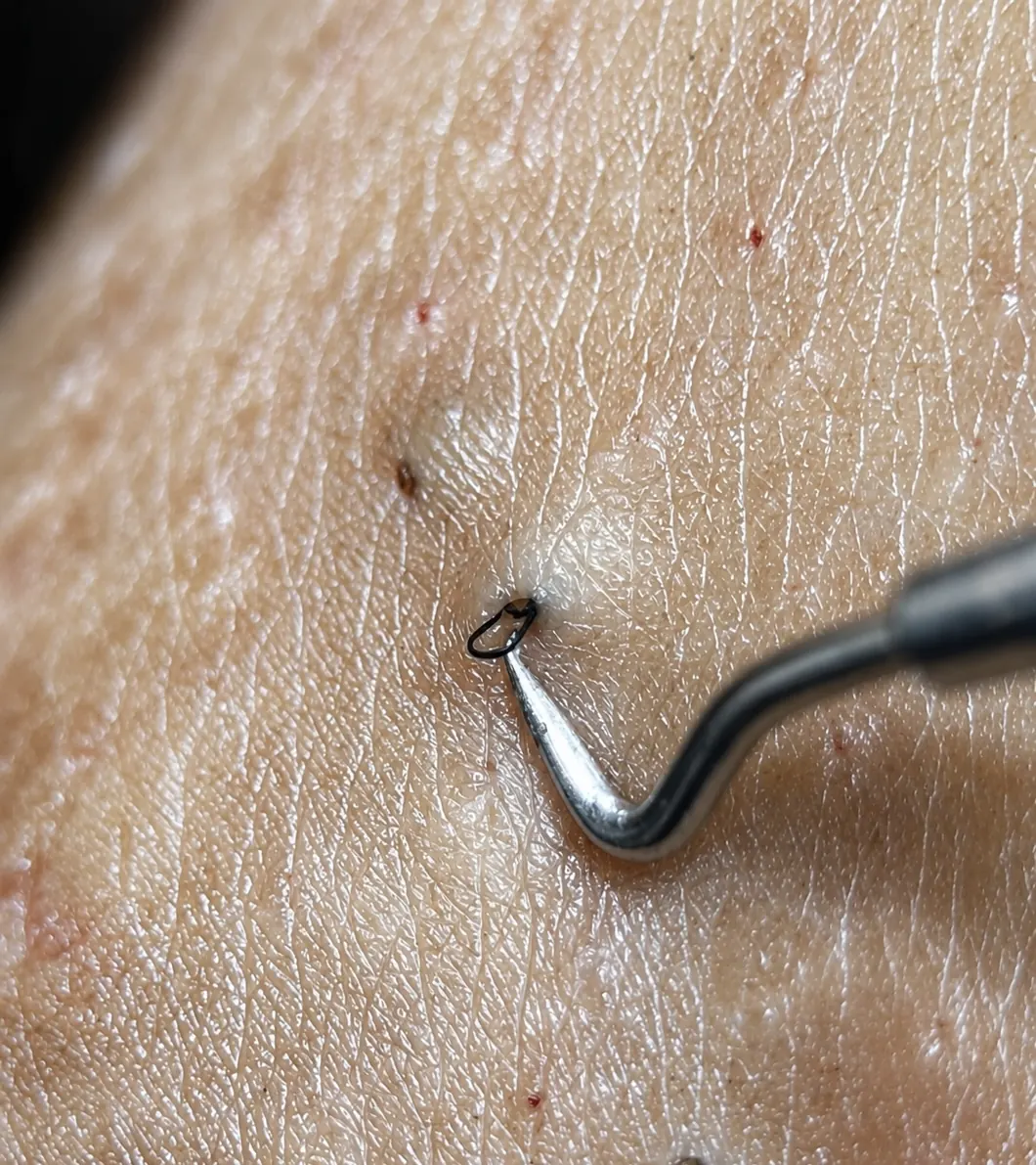 The Extraction Kit in use, detail 2